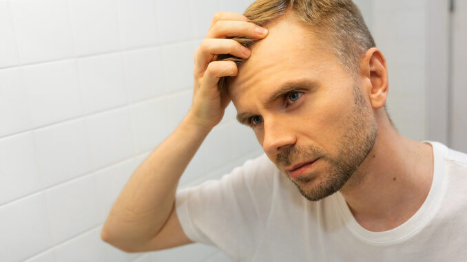 Haarausfall bei erhöhten Leberwerten Haarausfall bei erhöhten Leberwerten