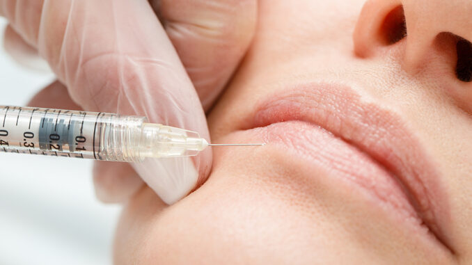Lippen aufspritzen Lippen aufspritzen